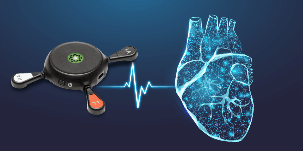 Remote patient monitor